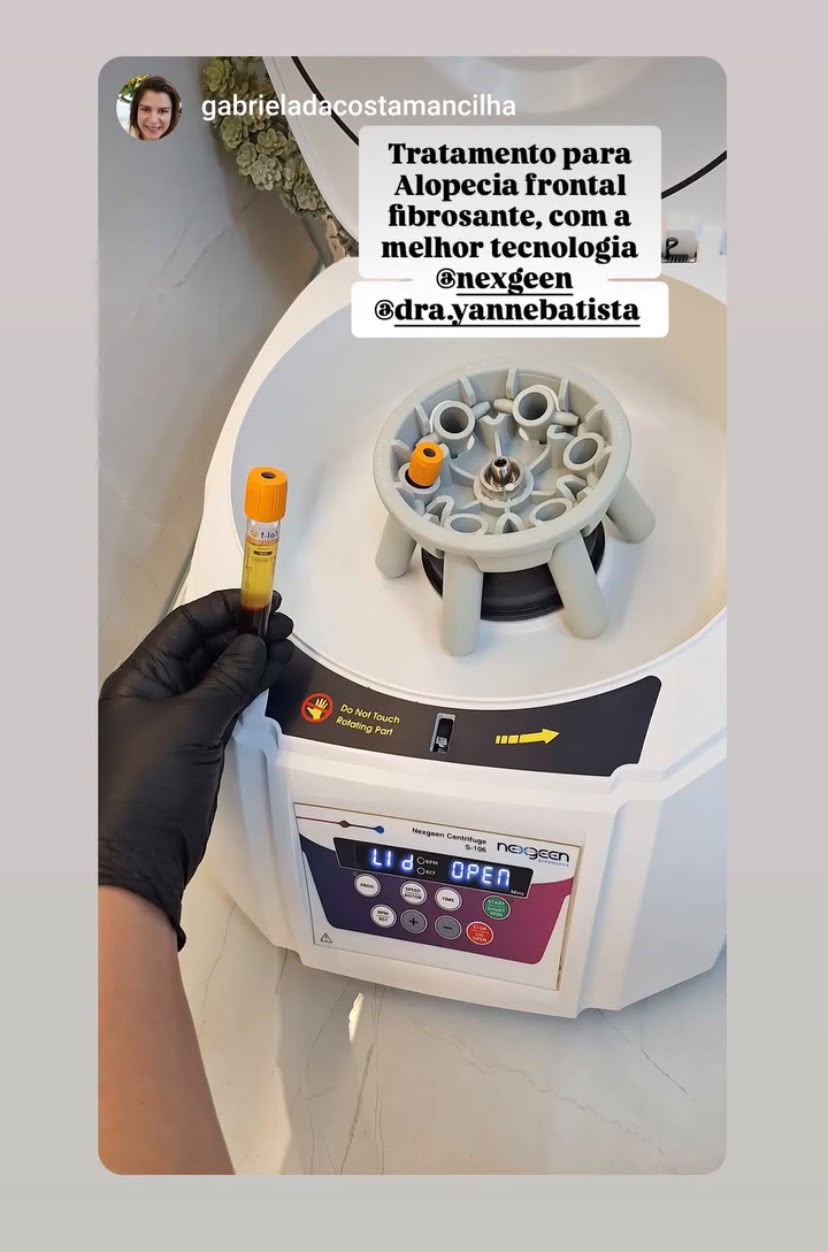 Registro do rotor basculante e de tubo PRP compartilhado por profissional